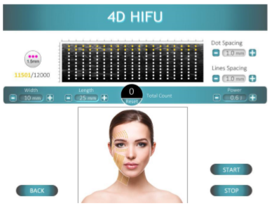 4D HIFU | プライベートクリニック恵比寿｜美容外科・美容皮膚科 