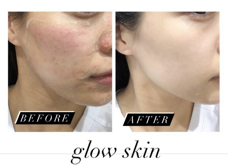 結婚式までに綺麗になりたい そんな願い叶える美容施術 プライベートクリニック恵比寿