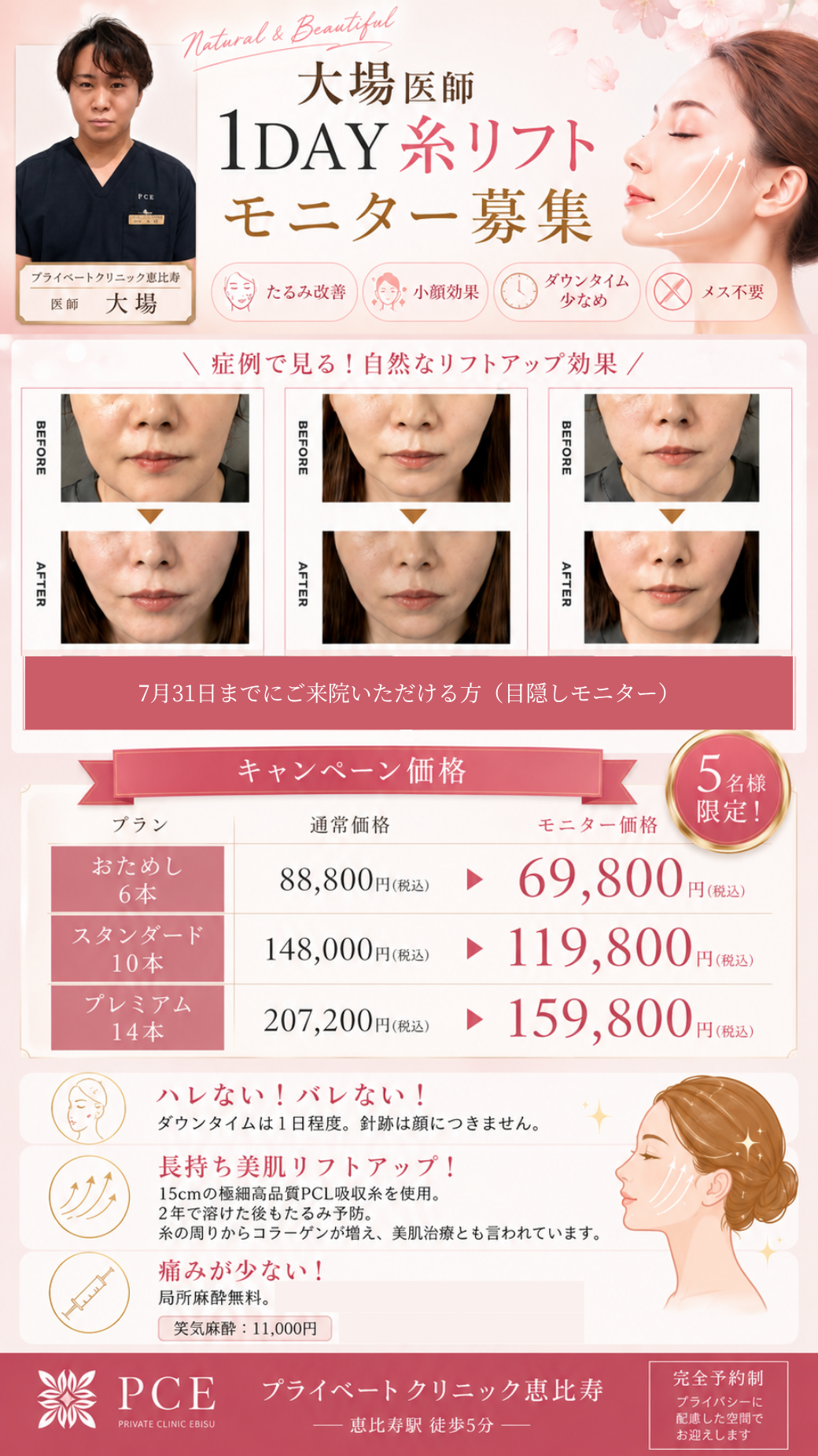 大場医師 1DAY糸リフト モニター募集|7月31日までにご来院いただける方(目隠しモニター)5名様限定|プライベートクリニック恵比寿